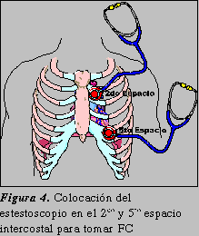 Regiones Tor�cica de Auscultaci�n